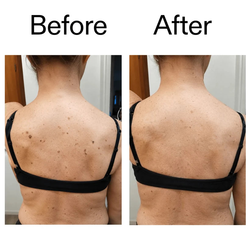 Customer before and after result on back